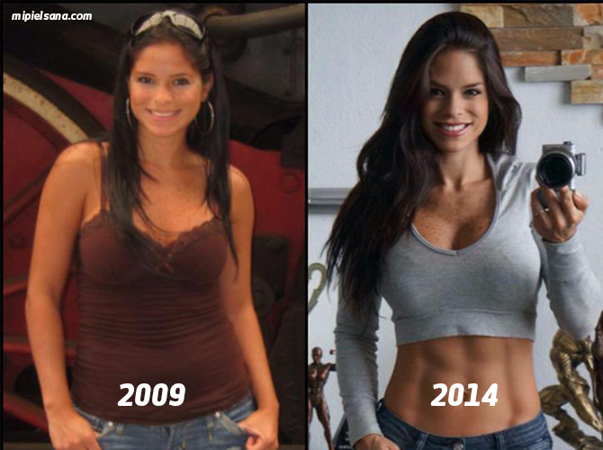 Michelle-Lewin-antes-y-despues